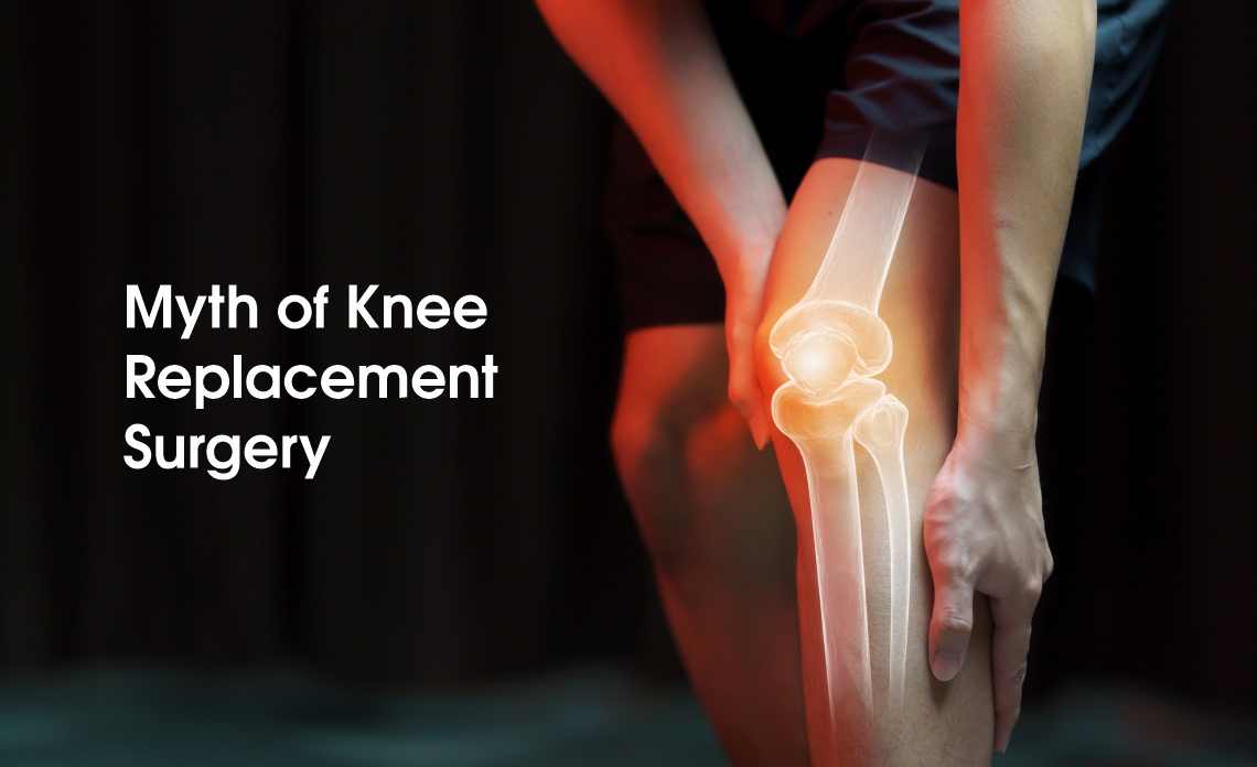 The myth and facts of Knee Replacement Surgery