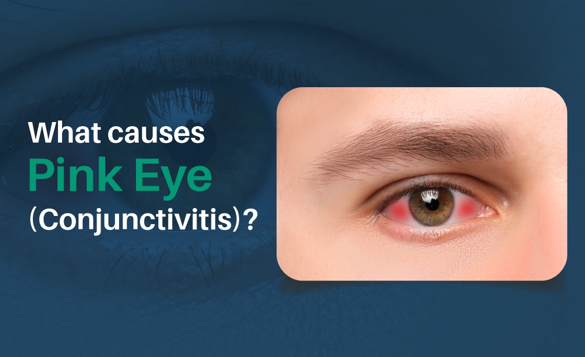 What causes Pink Eye (Conjunctivitis)?